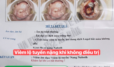 review-dia-chi-uy-tin-tai-ha-noi-chua-khoi-viem-lo-tuyen-co-tu-cung-han-che-tai-phat-hieu-qua-den-99-9